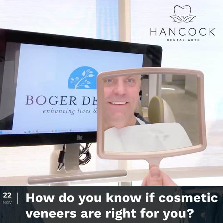 Blog post image: Are Cosmetic Veneers Right for You?